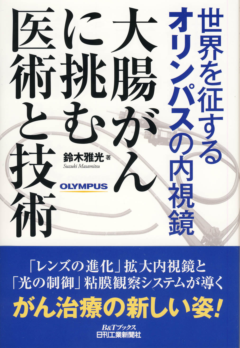 世界を征するオリンパスの内視鏡　大腸がんに挑む医術と技術